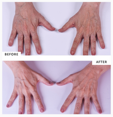 SILC SKIN - Hand and Body Treatment