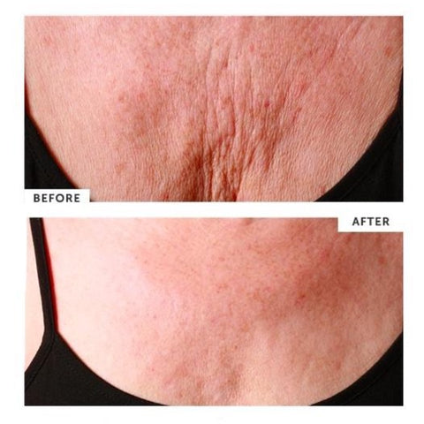 SILC SKIN - DECOLLETTE PAD