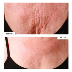 SILC SKIN - DECOLLETTE PAD