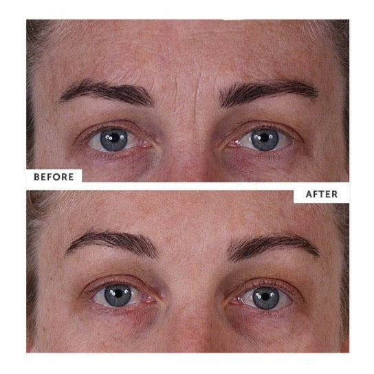 SILC SKIN - FULL FACE PADS