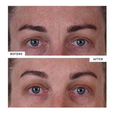 SILC SKIN - FULL FACE PADS