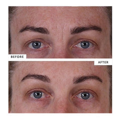 SILC SKIN - FULL FACE PADS